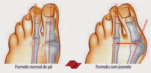 exame-medico-pm-joanete-edital