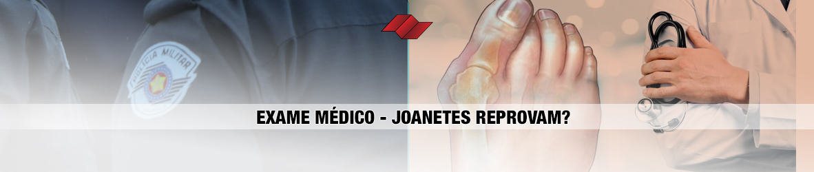 EXAME MÉDICO – JOANETES REPROVAM?